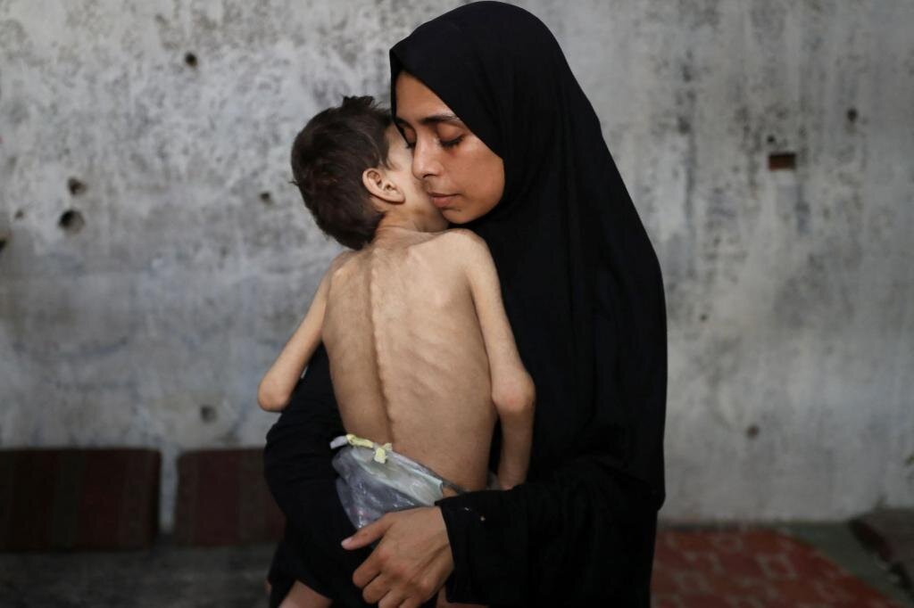 UN: Glad u Gazi je “katastrofa uzrokovana ljudskim djelovanjem”